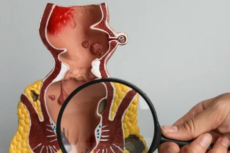 Chegou a hora de consultar com um Coloproctologista