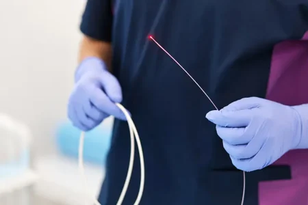 Laser Cirúrgico - Tecnologia Avançada para um Tratamento Mais Confortável e Preciso