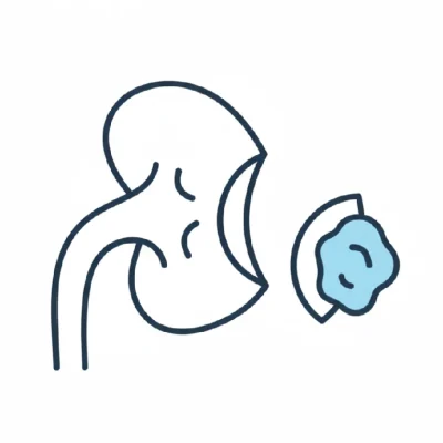 Nefrectomia parcial robótica