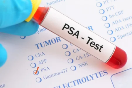 SEO - Entendendo o PSA Elevado Um Guia Completo sobre o Antígeno Prostático Específico