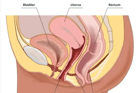 SEO - Prolapso Genital Grave Sintomas, Diagnóstico e Opções Avançadas de Tratamento
